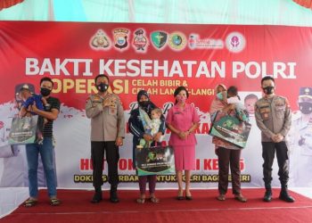Polda Maluku Utara Adakan Operasi Celah bibir dan celah langit-langit Gratis