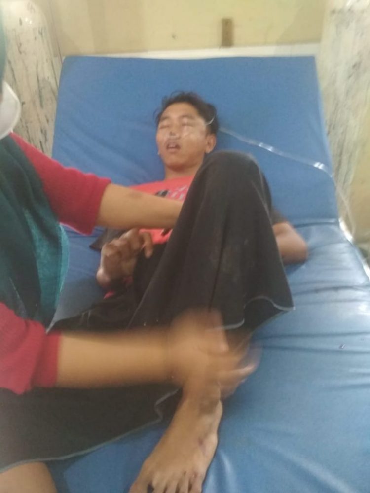 Tabrakan Mobil Pick Up dengan Sepeda Motor, Pengendara Luka Berat